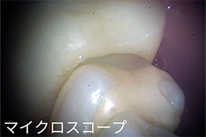マイクロ
